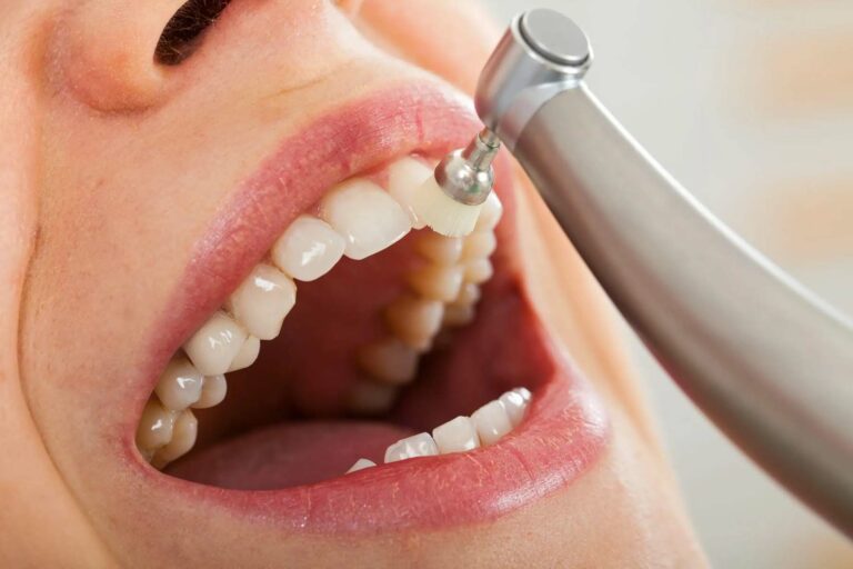 the-surprising-health-benefits-of-regular-dental-cleanings
